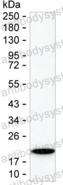 Anti-GKN1 Antibody (R3W96)