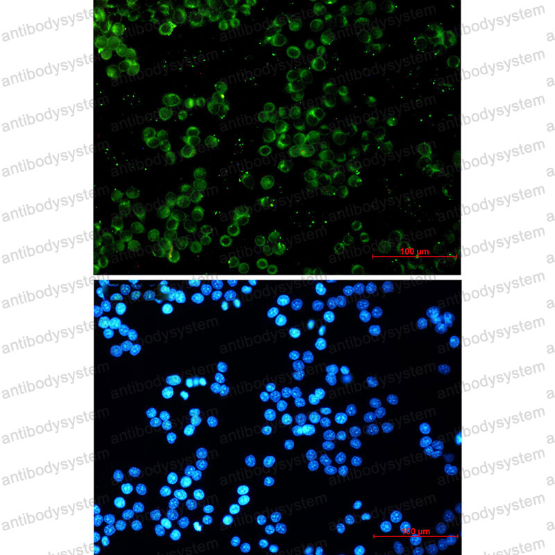 Anti-TREX1 Antibody (R2K48)