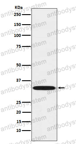 Anti-TREX1 Antibody (R2K47)