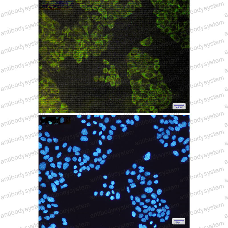 Anti-ATG3 Antibody (R2K49)