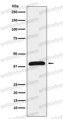 Anti-HIF1AN Antibody (R2K50)