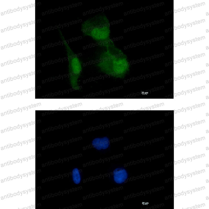 Anti-HIF1AN Antibody (R2K51)