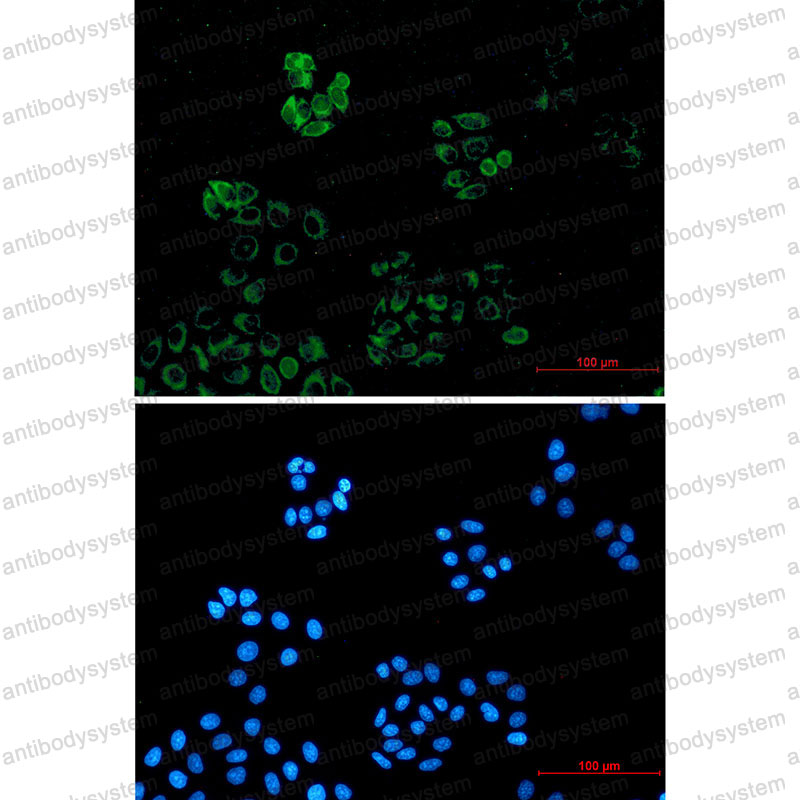 Anti-IRAK4 Antibody (R2K52)