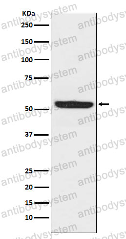 Anti-SPHK1 Antibody (R2K53)