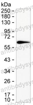 Anti-IL36G/IL-1F9 Antibody (R3X04)