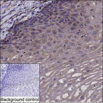 Anti-IL36G/IL-1F9 Antibody (R3X05)