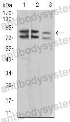 Anti-IL1RAPL1 Antibody (R3X06)