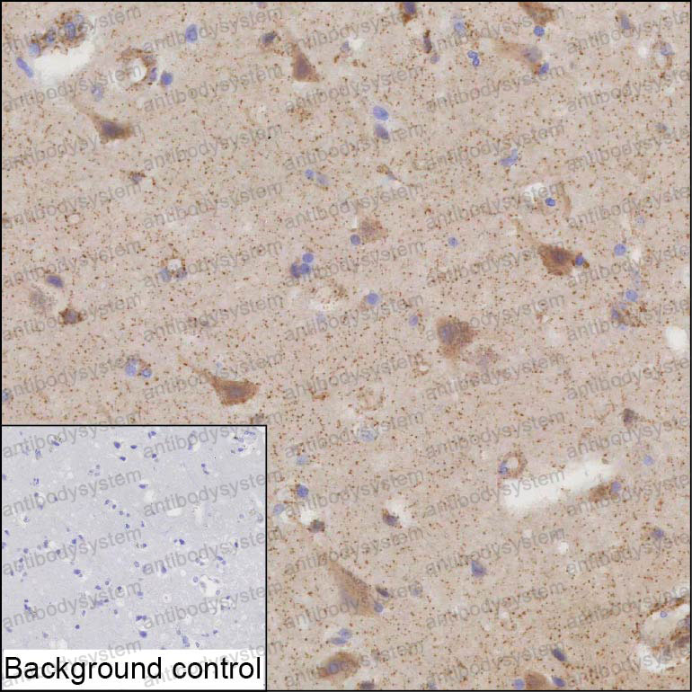 Anti-PDP1 Antibody (R3X11)