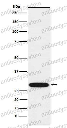 Anti-VAPA Antibody (R2K54)