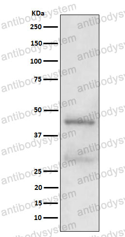 Anti-MBD2 Antibody (R2K59)