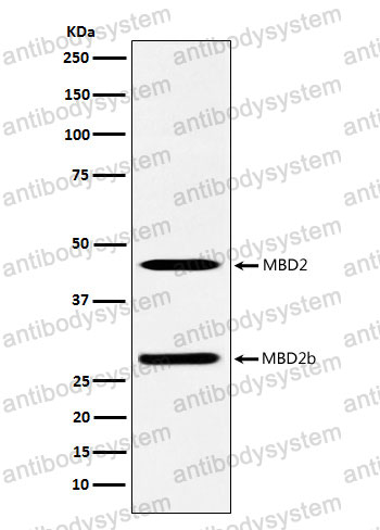 Anti-MBD2 Antibody (R2K58)