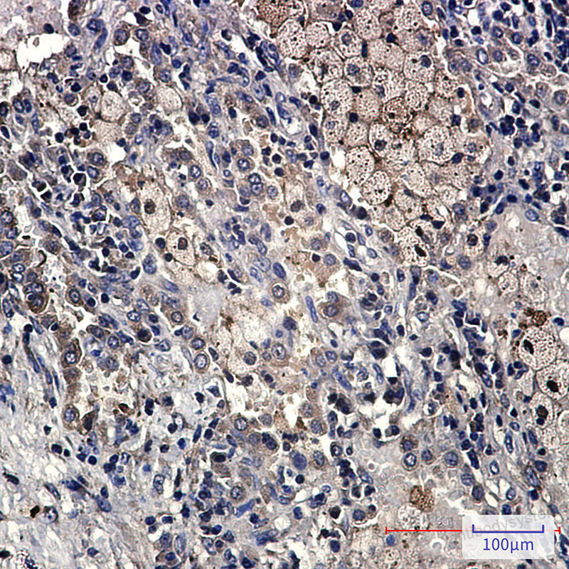 Anti-CD264/TNFRSF10D/TRAIL-R4 Antibody (R2K62)