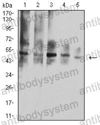 Anti-CD264/TNFRSF10D/TRAIL-R4 Antibody (R3X25)