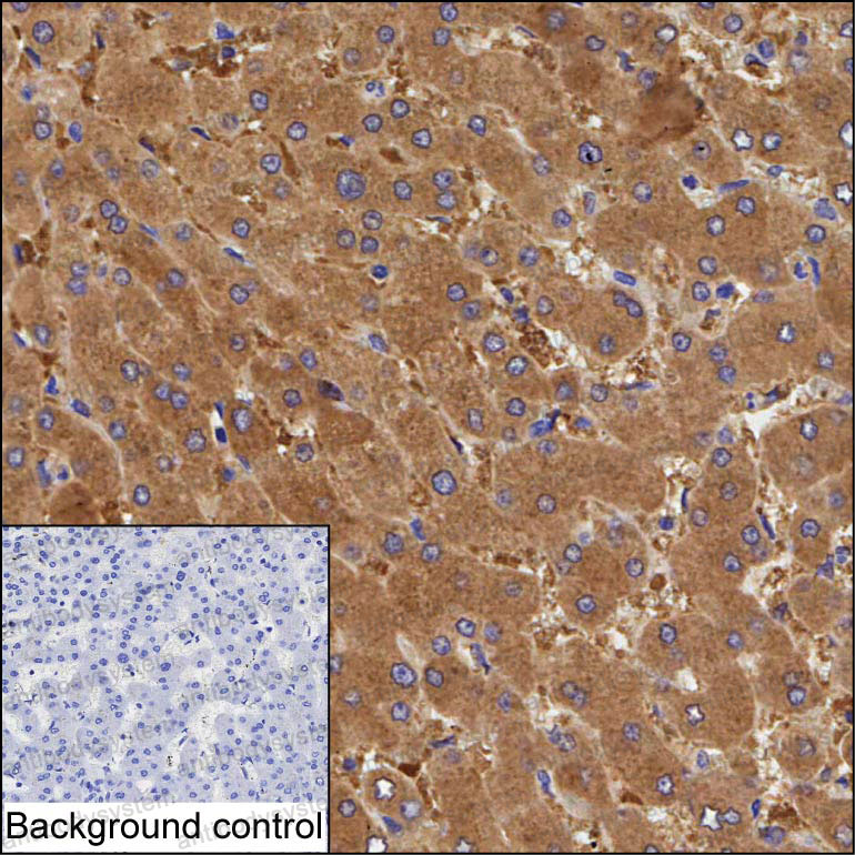 Anti-UPB1 Antibody (R3X30)