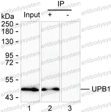 Anti-UPB1 Antibody (R3X31)