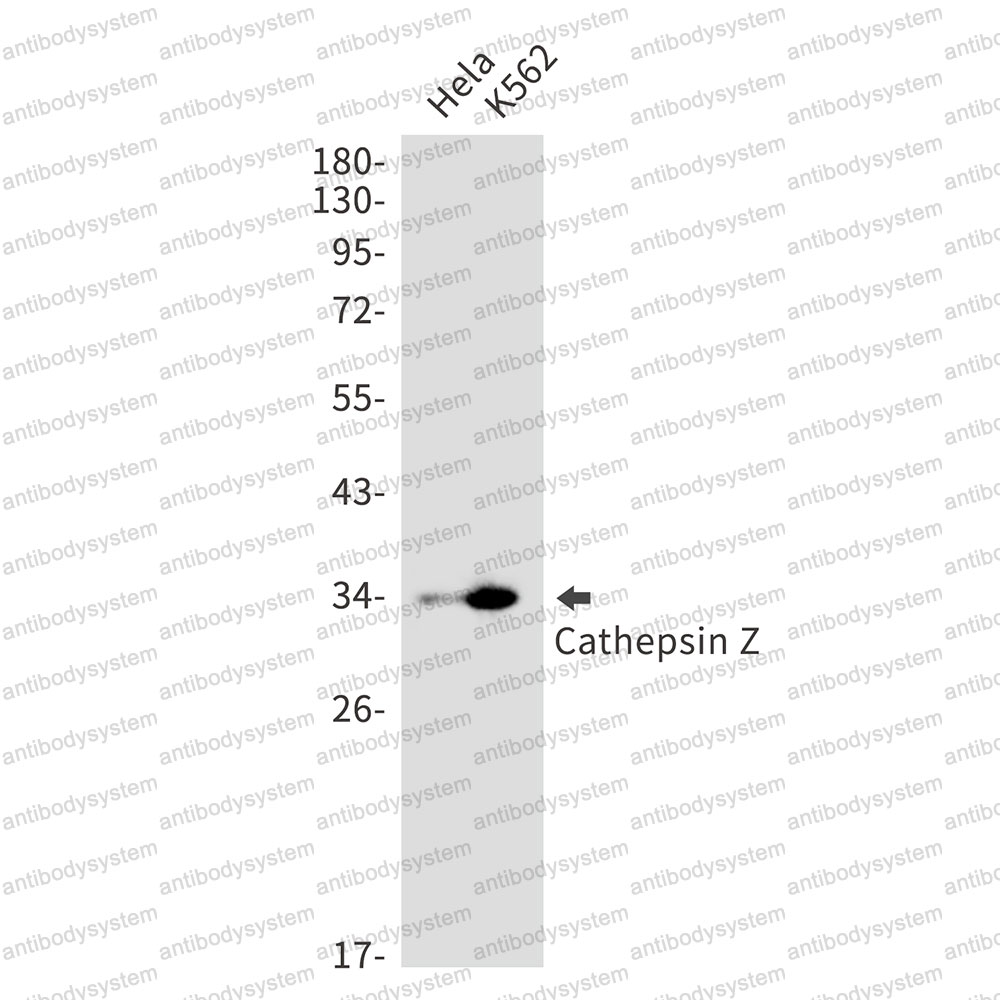 Anti-CTSZ Antibody (R2K63)