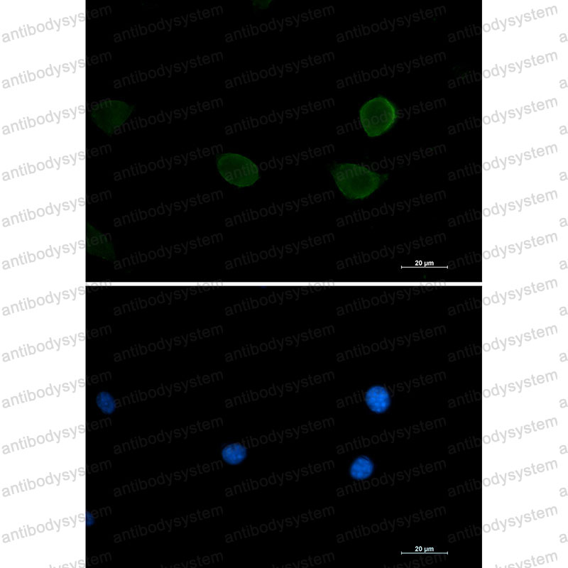 Anti-RPS6KB2 Antibody (R2K67)