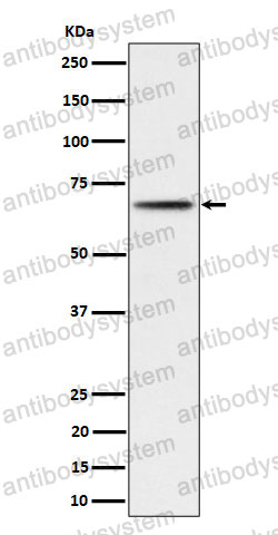 Anti-Phospho-RPS6KB2 (S371) Antibody (R2K65)