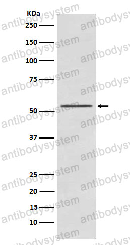 Anti-RPS6KB2 Antibody (R2K64)