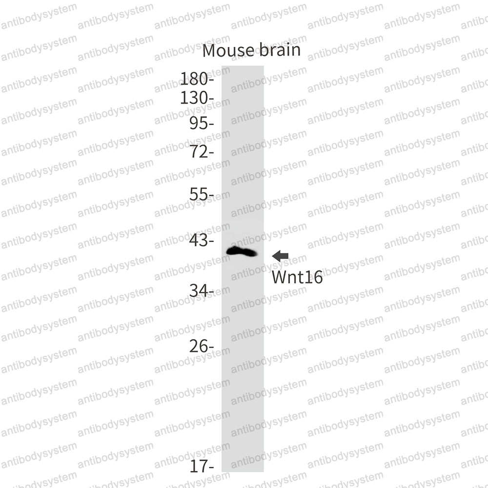 Anti-WNT16 Antibody (R2K69)