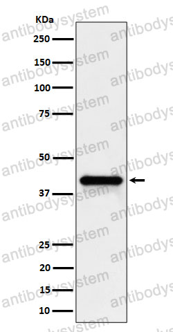 Anti-WNT16 Antibody (R2K68)