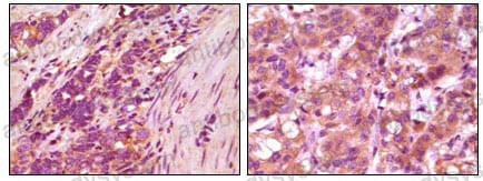 Anti-FBLN5 Antibody (R3X32)