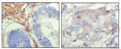 Anti-FBLN5 Antibody (R3X33)