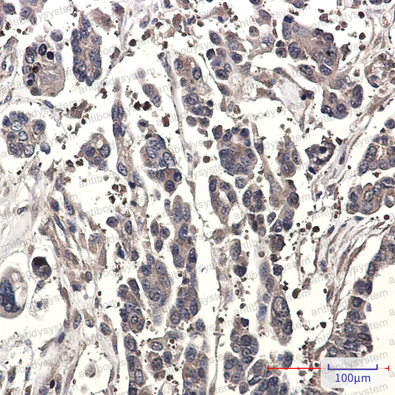 Anti-STK39 Antibody (R2K72)