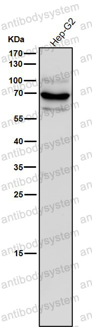 Anti-STK39 Antibody (R2K71)