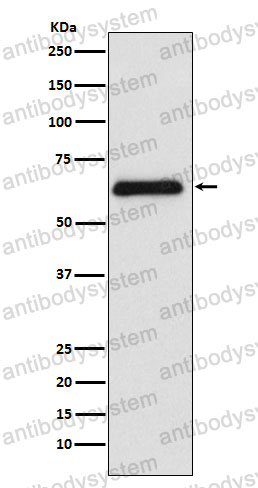 Anti-PARP2 Antibody (R2K73)