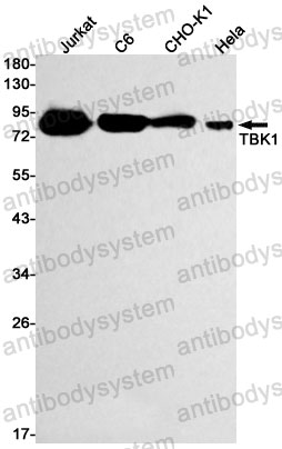 Anti-TBK1 Antibody (R2K77)