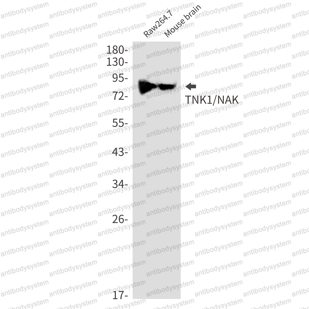 Anti-TBK1 Antibody (R2K76)