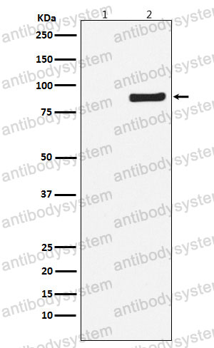 Anti-Phospho-NAK/TBK1 (S172) Antibody (R2K75)