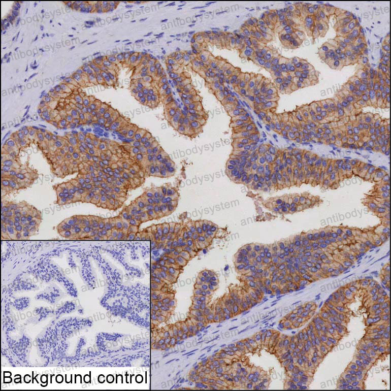 Anti-STEAP1 Antibody (R3X34)