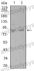 Anti-ADAMTS1 Antibody (R3X35)