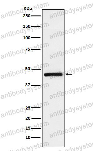 Anti-TMEFF2 Antibody (R2K78)