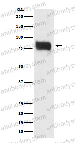 Anti-MBD1 Antibody (R2K79)