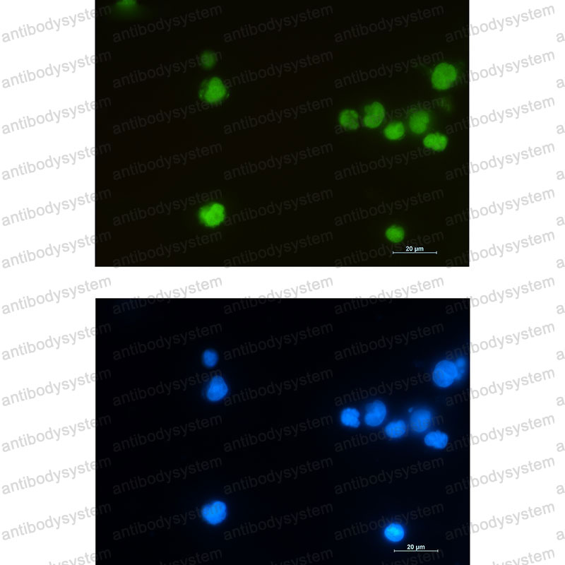 Anti-LEF1 Antibody (R2K80)
