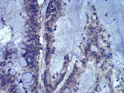Anti-LEF1 Antibody (R3X42)