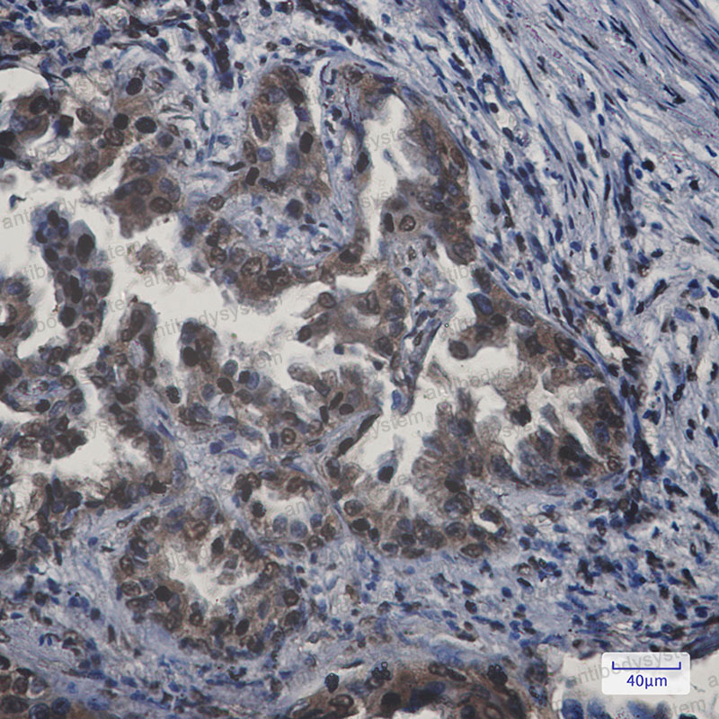 Anti-APPL1 Antibody (R2K82)