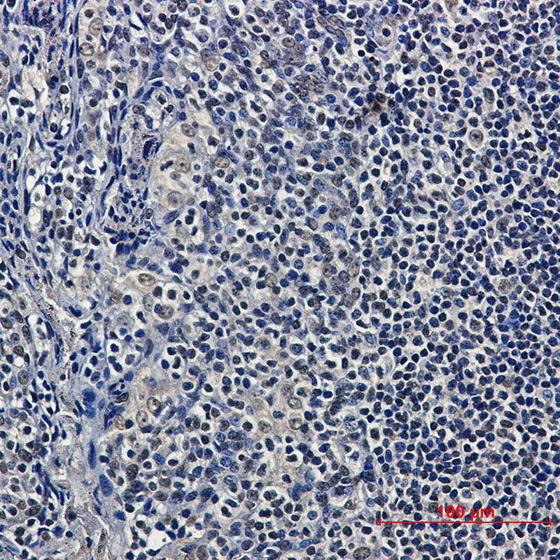Anti-HDAC9 Antibody (R2K83)