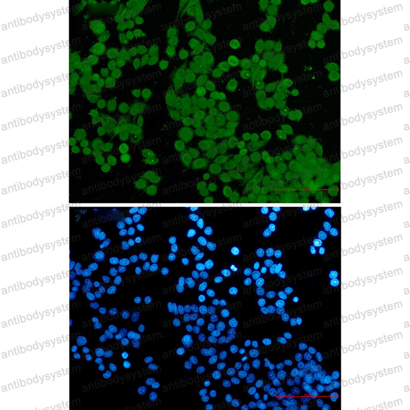 Anti-NUP50 Antibody (R2K89)