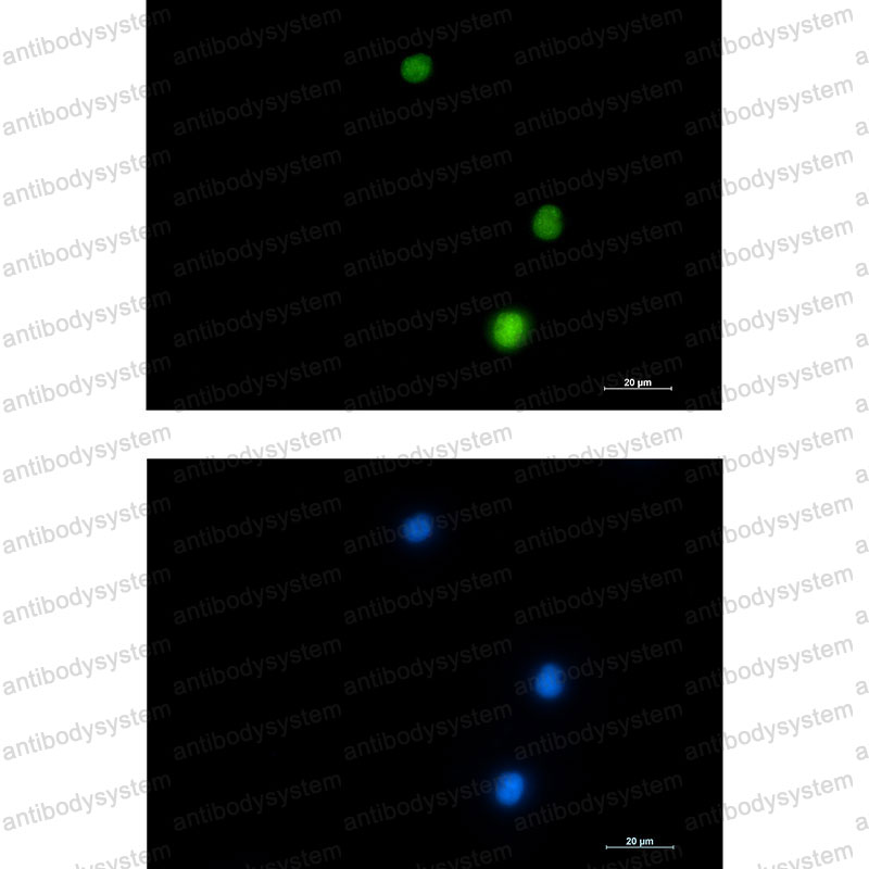 Anti-NUP50 Antibody (R2K88)