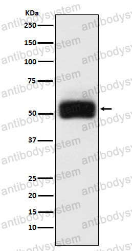 Anti-MMP17 Antibody (R2K90)