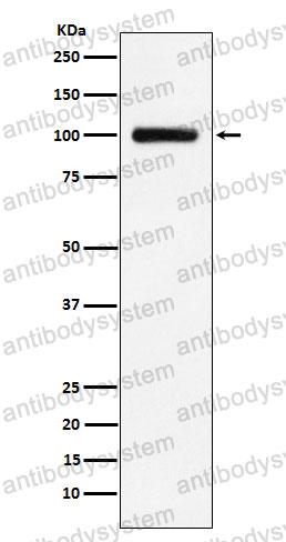 Anti-TFR2 Antibody (R2K92)