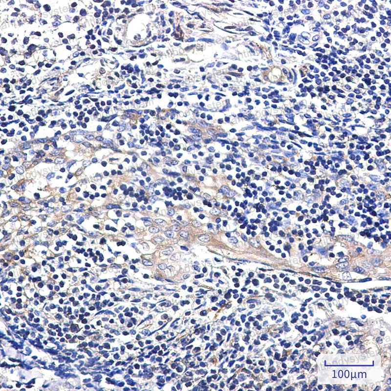 Anti-PA2G4 Antibody (R2K94)