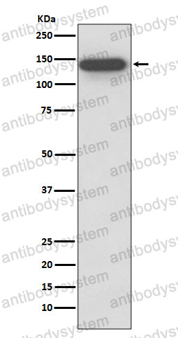 Anti-SMC3 Antibody (R2K95)