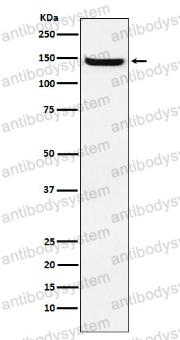 Anti-JAG2 Antibody (R2K96)