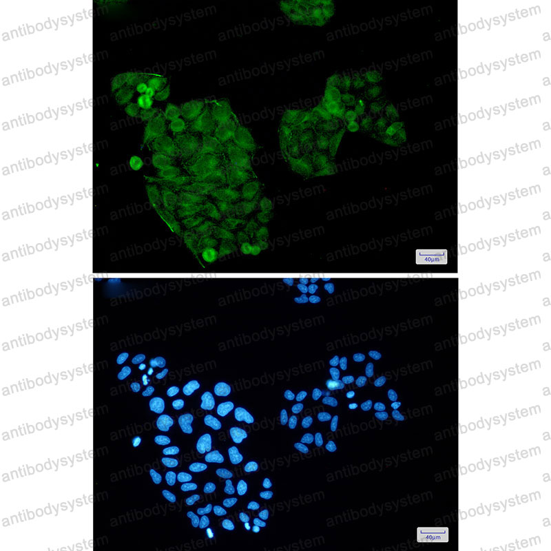 Anti-AKT3 Antibody (R2K99)