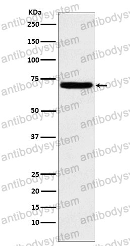 Anti-HPSE Antibody (R2L01)